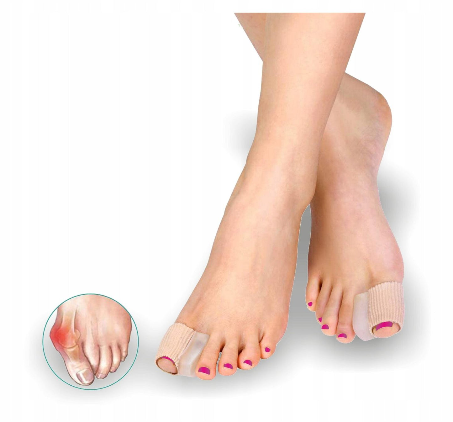 Hallux valgus orthosis