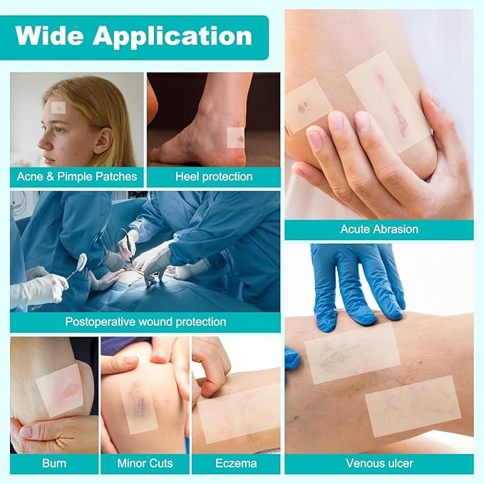 Hydrocolloid Roll for Wound Care